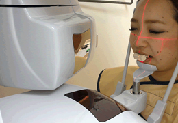 レントゲン撮影