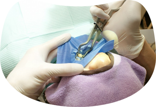 ラバーダム防湿